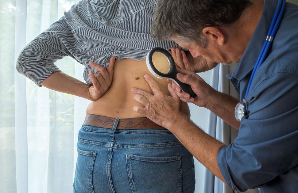 Pour lutter contre la pénurie de dermatologues en Occitanie, treize kinés se sont formés au dépistage du mélanome