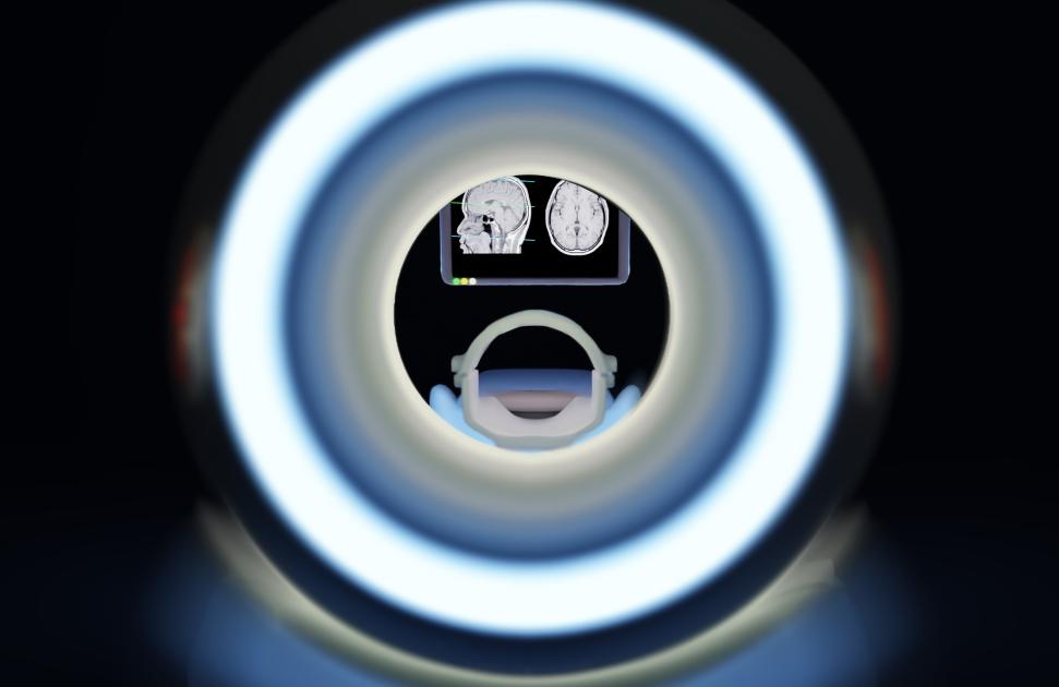 Quand la radiologie se met au service du pluripro : portrait de Jonathan Brami