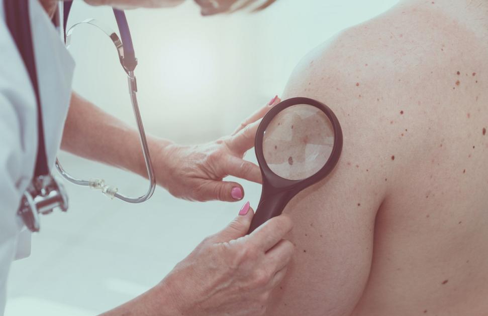 La Société Français de dermatologie lance Mobil'derm, "une réponse concrète et pragmatique à un enjeu majeur de santé publique"