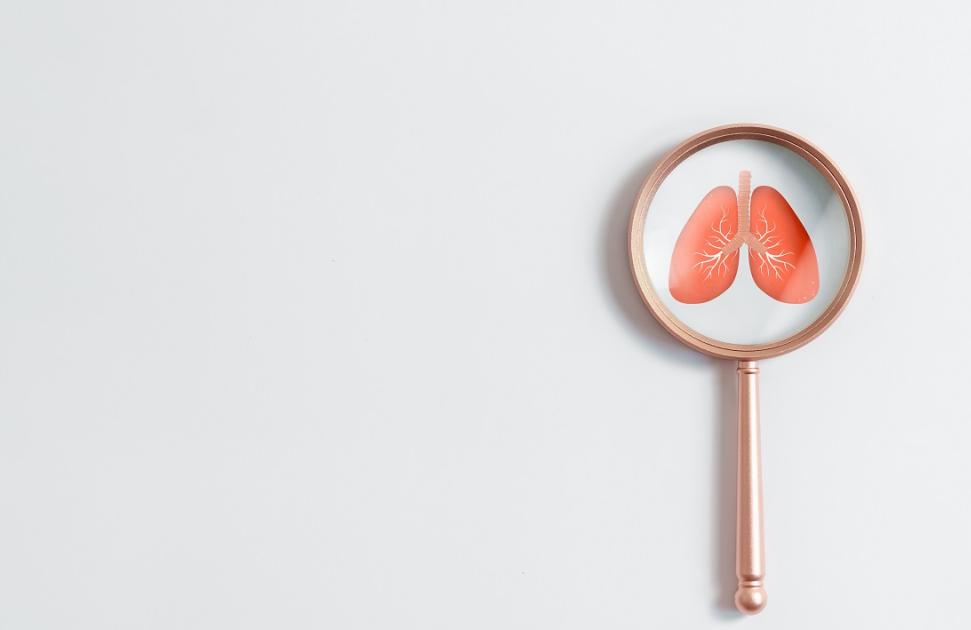 Cancer du poumon : le programme pilote "Impulsion" lance les bases d’un dépistage national