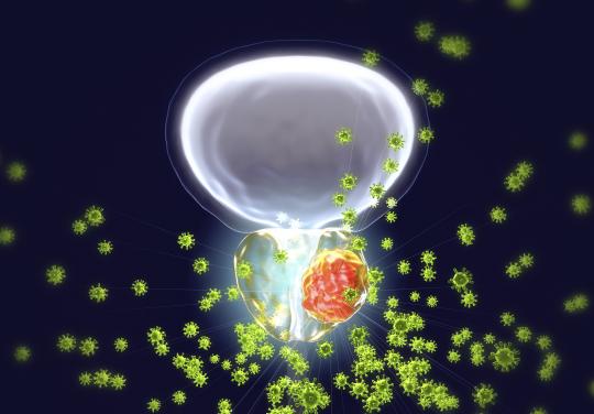 cancer prostate pesticide