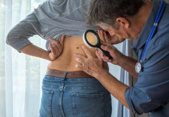 Pour lutter contre la pénurie de dermatologues en Occitanie, treize kinés se sont formés au dépistage du mélanome