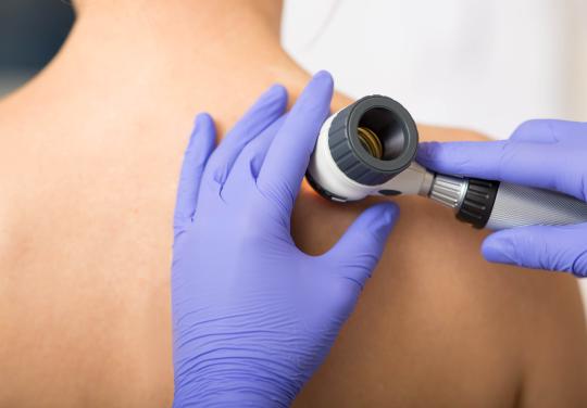 En Nouvelle-Aquitaine, l'ESS Dermato a accompagné plus de 1.000 patients et mobilisé 17 professionnels spécialisés